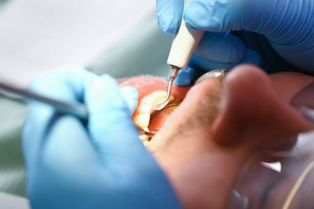 Best Dentist for Tooth Abscess  in Willits, CA